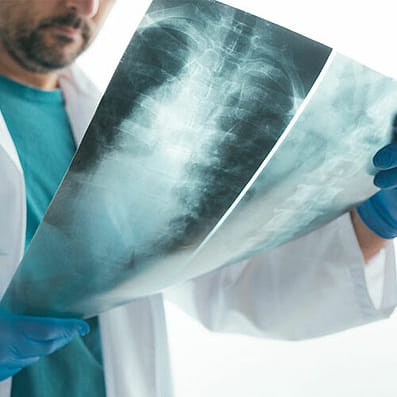 How is Quality of Life Impacted by Spine Surgery? 2 Spinal Xray