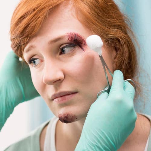 Abrasions and Lacerations injury lawyer