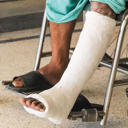 broken bones injury lawyers