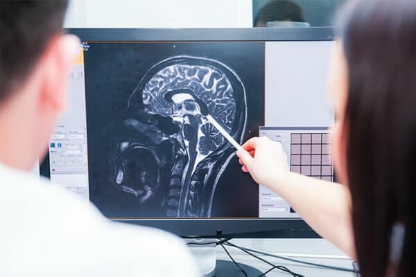 TBI attorney
