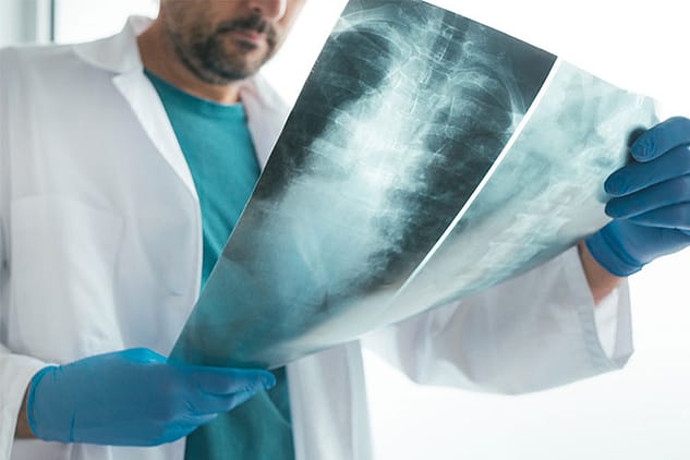 Spinal Xray